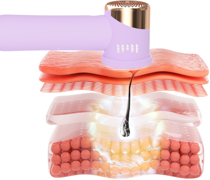 FOREO PEACH 2 Go - IPL hair removal system, Lavender how it works