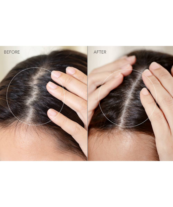 FOREO LUNA 4 hair 2-in-1 LED Scalp Massager before and after