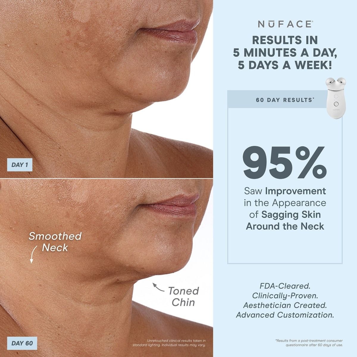 NuFACE Trinity+ Smart Advanced Facial Toning Kit | ROX Beauty NuFACE Trinity+ Smart Advanced Facial Toning Kit | ROX Beauty